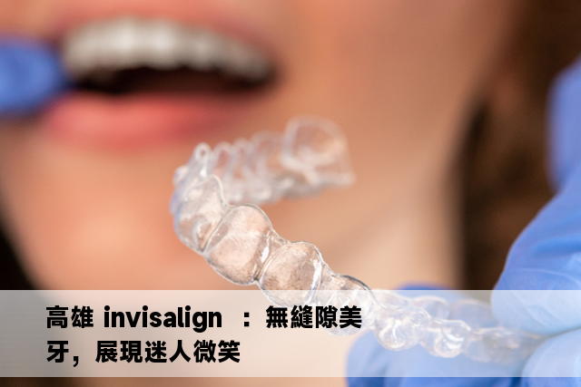 高雄 invisalign  ：無縫隙美牙，展現迷人微笑