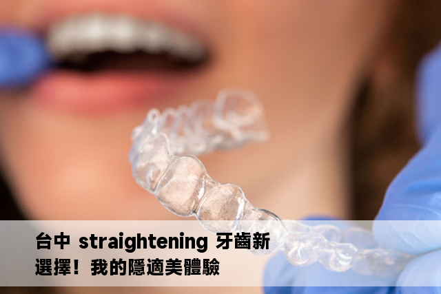 台中 straightening 牙齒新選擇！我的隱適美體驗